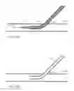 Fig. 35 - CHITOSAN AND POLYETHYLENE GLYCOL COPOLYMERS AND METHODS AND DEVICES FOR USING SAME FOR SEALING A VASCULAR PUNCTURE