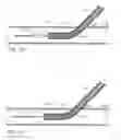 Fig. 37 - CHITOSAN AND POLYETHYLENE GLYCOL COPOLYMERS AND METHODS AND DEVICES FOR USING SAME FOR SEALING A VASCULAR PUNCTURE