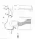 Fig. 04 - Remote spinal manipulating assembly and method for remote spinal manipulation