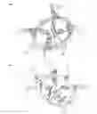 Fig. 02 - Surgical retractor