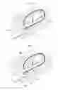 Fig. 04 - Suture body and suture system