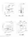 Fig. 131 - Systems and methods for increased operating room efficiency