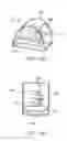 Fig. 80 - Systems and methods for increased operating room efficiency