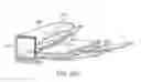 Fig. 85 - Systems and methods for increased operating room efficiency