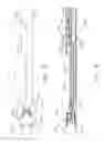 Fig. 09 - AXIALLY MOVABLE CLOSURE SYSTEM ARRANGEMENTS FOR APPLYING CLOSURE MOTIONS TO JAWS OF SURGICAL INSTRUMENTS