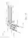 Fig. 13 - Articulation lock arrangements for locking an end effector in an articulated position in response to actuation of a jaw closure system
