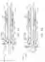 Fig. 41 - Method for attaching a shaft assembly to a surgical instrument and, alternatively, to a surgical robot