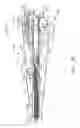 Fig. 25 - Surgical system comprising a firing member rotatable into an articulation state to articulate an end effector of the surgical system