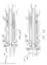 Fig. 41 - Surgical system comprising a firing member rotatable into an articulation state to articulate an end effector of the surgical system