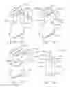Fig. 17 - Surgical instrument comprising improved jaw control