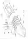 Fig. 48 - Surgical instrument comprising improved jaw control