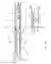 Fig. 34 - METHOD OF DEFORMING STAPLES FROM TWO DIFFERENT TYPES OF STAPLE CARTRIDGES WITH THE SAME SURGICAL STAPLING INSTRUMENT