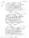 Fig. 95 - METHOD OF DEFORMING STAPLES FROM TWO DIFFERENT TYPES OF STAPLE CARTRIDGES WITH THE SAME SURGICAL STAPLING INSTRUMENT