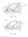 Fig. 23 - Staple forming pocket arrangements