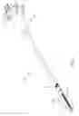 Fig. 05 - Surgical instrument with primary and safety processors