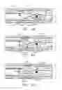 Fig. 30 - Articulatable surgical end effector with asymmetric shaft arrangement