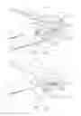 Fig. 17 - Surgical instruments with jaw opening features for increasing a jaw opening distance