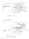Fig. 14 - Surgical end effectors with expandable tissue stop arrangements