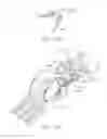 Fig. 18 - Surgical end effectors with expandable tissue stop arrangements