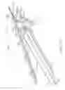 Fig. 22 - Lockout arrangements for surgical end effectors