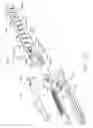 Fig. 52 - Lockout arrangements for surgical end effectors