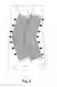 Fig. 09 - Magnetic wound closure device and method of use