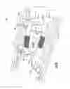 Fig. 03 - Magnetically activated arteriovenous access valve system and related methods