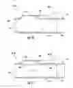 Fig. 11 - Magnetically activated arteriovenous access valve system and related methods