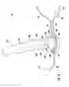 Fig. 12 - Magnetically activated arteriovenous access valve system and related methods