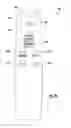 Fig. 25 - Magnetically activated arteriovenous access valve system and related methods