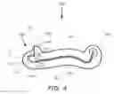 Fig. 06 - Ligation clip