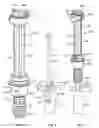 Fig. 02 - System for orthopedic implantation preparation
