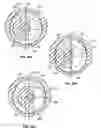 Fig. 13 - System for orthopedic implantation preparation