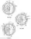 Fig. 14 - System for orthopedic implantation preparation