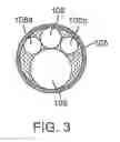 Fig. 04 - Medical systems and methods