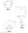 Fig. 03 - Scanning ureteroscope for maximizing efficiency in laser lithotripsy