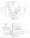 Fig. 13 - Implant remover
