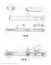 Fig. 08 - Radiolucent grasping device