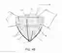 Fig. 06 - Laparoscopic morcellating receptacle and methods of use