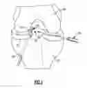 Fig. 02 - Cartilage trimmers and associated methods