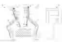 Fig. 01 - Trocar with reduced profile