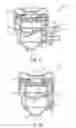 Fig. 03 - Trocar with reduced profile