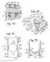Fig. 26 - Pivotal bone anchor with bottom-loaded shank and tool-deployable interference fit rod-engaging insert
