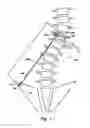 Fig. 02 - Device and method for treatment of spinal deformity
