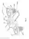 Fig. 08 - Device and method for treatment of spinal deformity