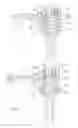 Fig. 07 - Spinal stabilization system with head to head cross connector