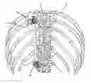 Fig. 01 - Bone hook apparatus