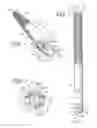 Fig. 02 - ORTHOPEDIC IMPLANT ROD REDUCTION TOOL SET AND METHOD