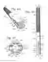 Fig. 15 - ORTHOPEDIC IMPLANT ROD REDUCTION TOOL SET AND METHOD