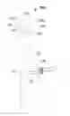 Fig. 01 - BONE REDUCTION AND INTERNAL FIXATION APPARATUS AND METHOD FOR USING SAME